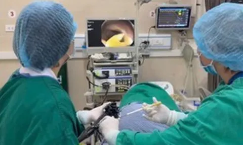 Thường xuyên ăn thịt bò tái, đi khám, người đàn ông phát hiện sán dây bò dài 1,2 mét trong ruột