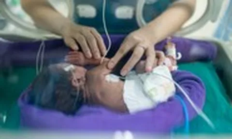 Úc phát triển nhau thai nhân tạo, mở ra hy vọng mới cho trẻ sinh non