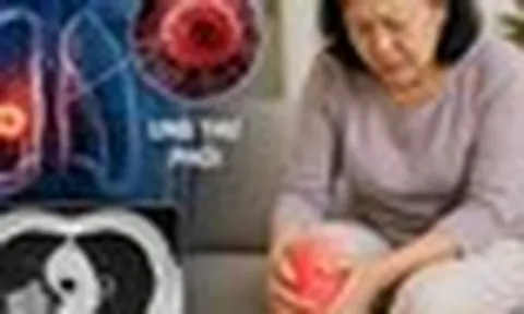 Bác sĩ cảnh báo: 3 DẤU HIỆU quan trọng của ung thư phổi, nhiều người chủ quan vì nghĩ đau chân do thời tiết