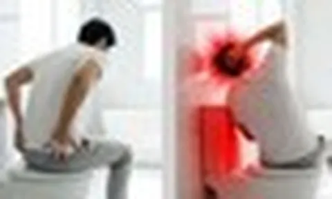 Bác sĩ cảnh báo 1 hành động khi đại tiện dễ gây đột quỵ: Hiếm ai chưa từng làm trong đời
