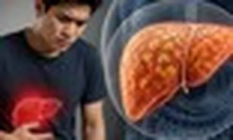 Gan nhiễm mỡ "ghé thăm" ngày càng nhiều người trẻ: Nếu có 7 THÓI QUEN này, bạn cần thay đổi ngay trước tuổi 40