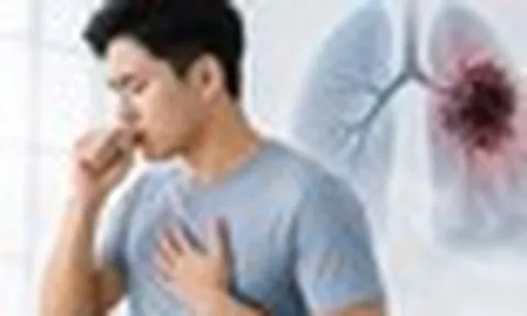 Không phải cơn ho: Bác sĩ cho biết ngón tay đôi khi là nơi đầu tiên cảnh báo ung thư phổi