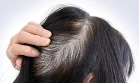 Mới chút xíu tuổi tóc đã bạc