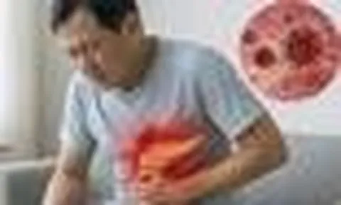 Ung thư tuyến tụy thường "ngụy trang" thành bệnh dạ dày: 6 thay đổi của cơ thể nhiều người dễ bỏ qua