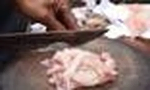 Người đàn ông mắt phải teo nhỏ suốt 12 năm, bác sĩ mổ tủy sống phát hiện "thủ phạm" là thói quen vạn người mê