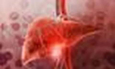 Không uống rượu bia nhưng gan vẫn có thể xuống cấp không phanh chỉ vì 9 thói quen này