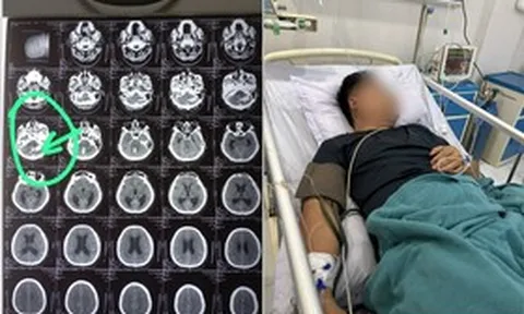 Người vợ quyết đưa chồng vượt 1.000km về Việt Nam giành lại sự sống