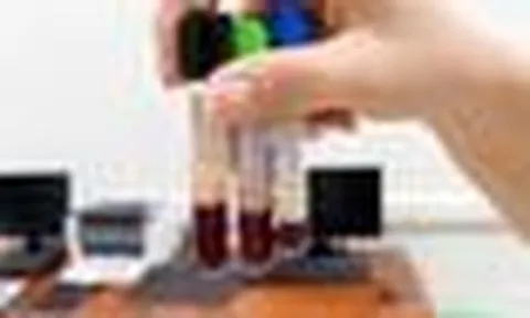 Ống máu xuất hiện màu lạ, chỉ số xét nghiệm của bệnh nhân khiến bác sĩ lo ngại