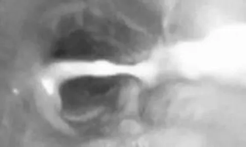 Bé trai 3 tuổi ho suốt 1 tháng, gia đình sửng sốt khi biết lý do