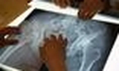 Cụ bà 70 tuổi có xương trẻ khỏe như phụ nữ 30, bác sĩ kinh ngạc khi biết bí quyết