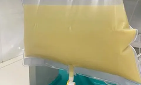 Nam thanh niên "máu trắng đục như sữa" vì ăn thứ quen thuộc nhiều người mê