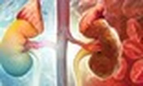 Cảnh báo 'mắt xích' hàng đầu âm thầm gây suy thận: Thật may vì có 3 thói quen 'cứu cánh'