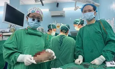 Bé 5 ngày tuổi có khối u quái nặng 1,3 kg