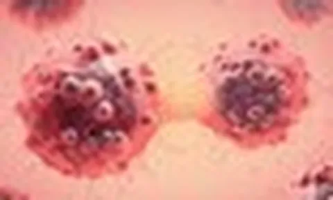 Người trẻ đừng nghĩ "ung thư chưa đến lượt mình”: Bác sĩ Bệnh viện K cảnh báo 7 dấu hiệu cần đi khám
