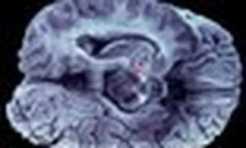 Phát hiện cấu trúc chưa từng được mô tả trong não, mở ra hướng điều trị ung thư