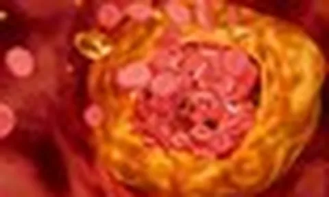 1 loại chất béo nhưng lại giúp "quét" sạch mỡ máu xấu: Chuyên gia tim mạch có lưu ý quan trọng