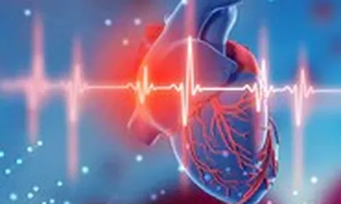 Trước khi lên cơn đau tim, cơ thể có phản ứng nào đáng chú ý?