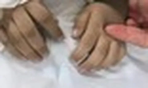 Bé 3 tuổi tím tái, bác sĩ phát hiện ngộ độc nitrit: 6 kiểu đồ ăn thừa cha mẹ nên lưu ý