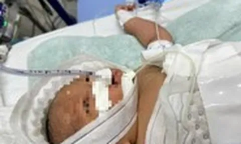 Bệnh viện Nhi đồng TP Cần Thơ lần đầu dùng kỹ thuật hạ thân nhiệt chỉ huy chữa trẻ sơ sinh bị thiếu oxy não