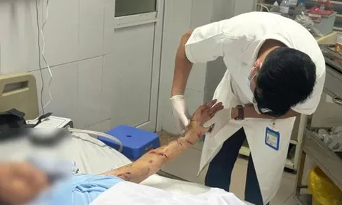 Nằm liệt giường, cụ bà 76 tuổi vẫn bị chó nhà tấn công phải nhập viện