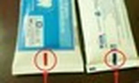 Hơn 90% người dùng hiểu lầm về vạch màu ẩn dưới đáy tuýp kem đánh răng