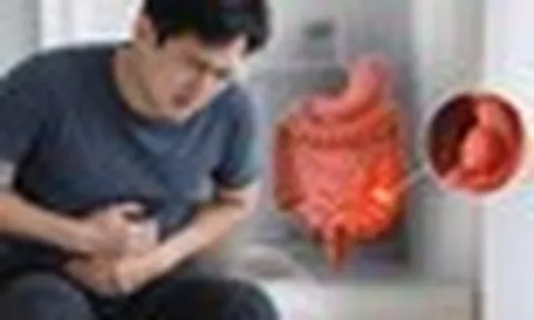Bác sĩ bệnh viện Bạch Mai cảnh báo 4 DẤU HIỆU ung thư đường tiêu hóa: Nhiều người gặp nhưng chủ quan bỏ qua