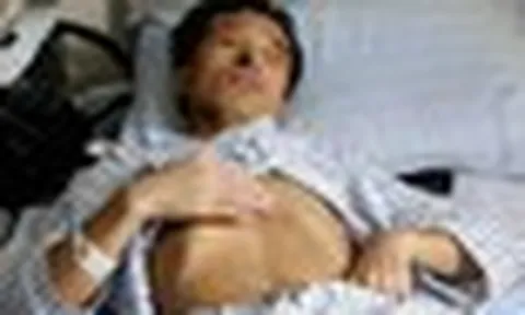 Người đàn ông 53 tuổi nhận "án tử" ung thư gan, bác sĩ tức giận: Đừng làm việc này quá 3 lần 1 tháng!