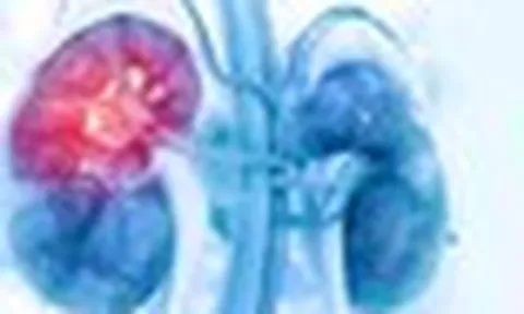 Chuyên gia Mỹ: Đây là dấu hiệu đầu tiên của bệnh thận, chớ nên bỏ qua