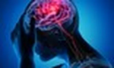 Đang đi mà thấy dấu hiệu này, cẩn thận kẻo đột quỵ đã "gõ cửa"