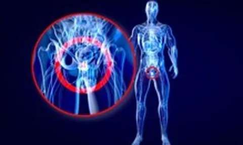 Thêm hy vọng cho bệnh nhân ung thư tuyến tiền liệt từ phương pháp xạ trị mới
