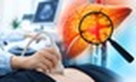 Chăm tập thể dục, kiêng chất béo nhưng gan vẫn nhiễm mỡ: Bác sĩ Bạch Mai chỉ ra nguyên nhân