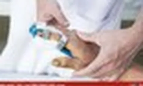 Bỏng nặng do điện thoại phát nổ khi đang sạc