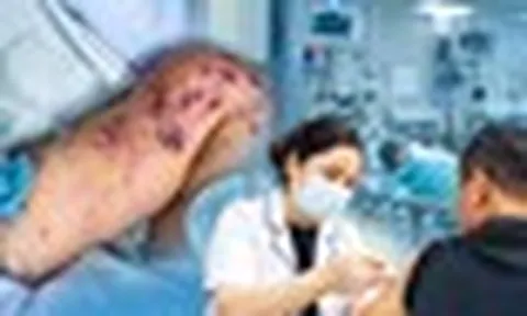 Căn bệnh truyền nhiễm diễn biến tối cấp, đe dọa tính mạng chỉ trong vài giờ: Ghi nhận ổ dịch tại TP.HCM