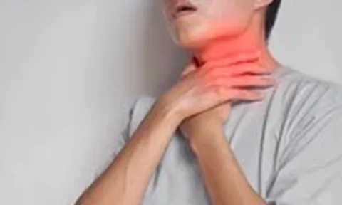 Đau họng kéo dài dù không ốm sốt hay cảm lạnh, nên nghĩ đến bệnh gì?