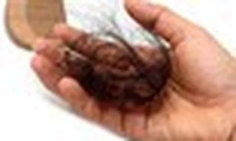 Lời khuyên cho những ai hay bị rụng tóc
