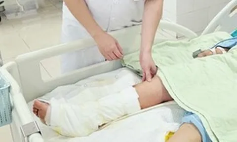 Đau nhói khi xỏ dép đi chợ, người phụ nữ đắp lá ớt rồi nhập viện vì chân hoại tử