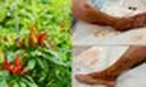 Bác sĩ giã lá ớt đắp vết thương khiến người phụ nữ 65 tuổi nhiễm trùng, hoại tử, nguy cơ mất chân
