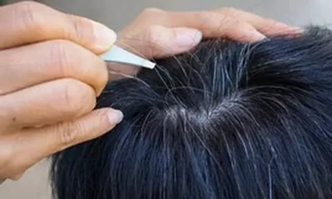 Lời khuyên cho những ai có tóc bạc sớm