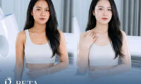 Bí quyết cải thiện làn da body đen sạm sau sinh an toàn, hiệu quả mà nhiều phụ nữ chưa biết