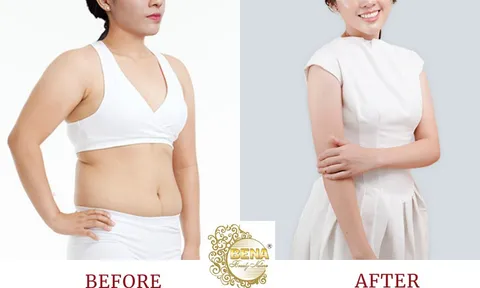 Thẩm mỹ viện giảm béo An toàn - Uy tín - Hiệu quả tại Hội An
