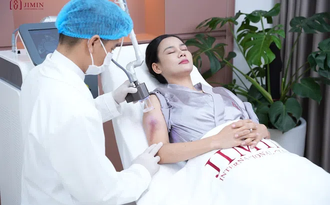 Cơn sốt điều trị sẹo với công nghệ Quang phổ điện từ Gentle Lab vẫn chưa có dấu hiệu hạ nhiệt