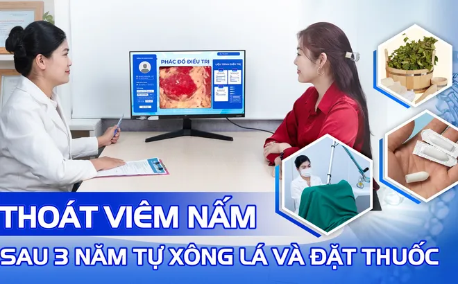 Từng tự xông lá, đặt thuốc tại nhà nhưng không khỏi, người phụ nữ 38 tuổi thoát viêm nấm tái phát sau khi điều trị đúng cách